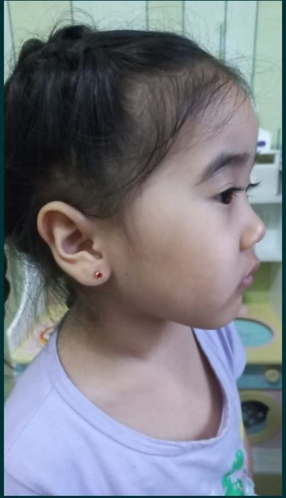 Прокол ушей, носа 5000