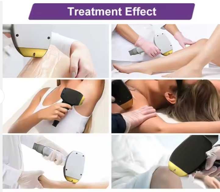 Косметологический аппарат Alma Soprano Titanium