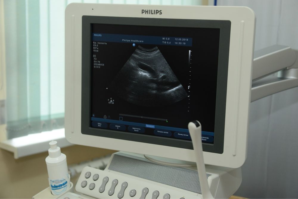 Аппарат УЗИ Philips