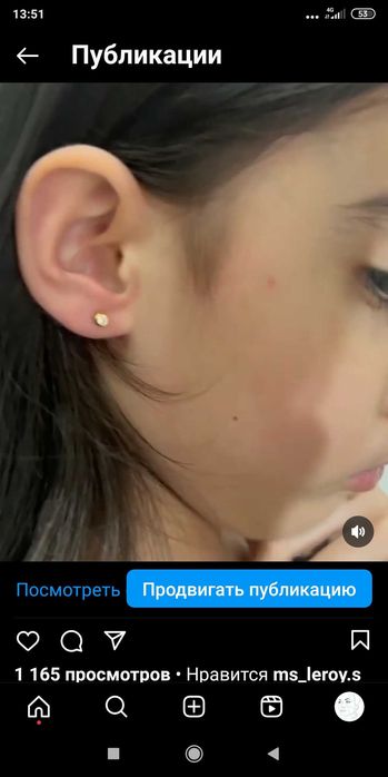 Прокалывание ушей взрослым и детям