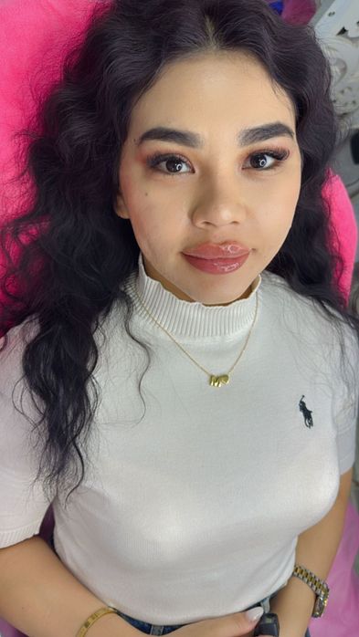 Лабга филлер ботекс