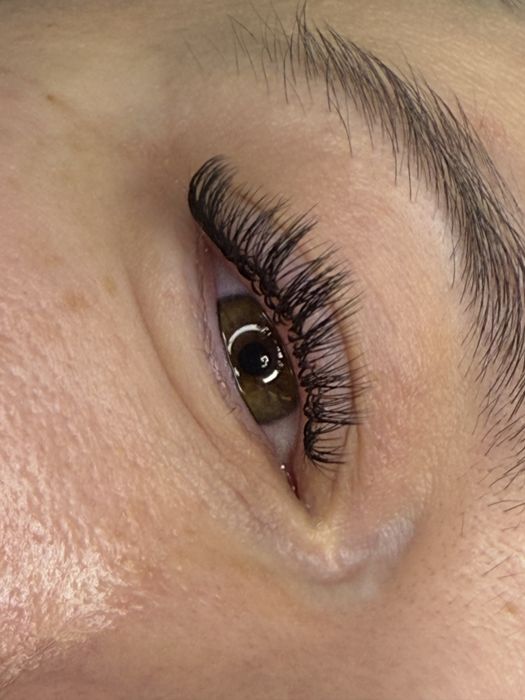 Aplicare extensii gene 1-3D