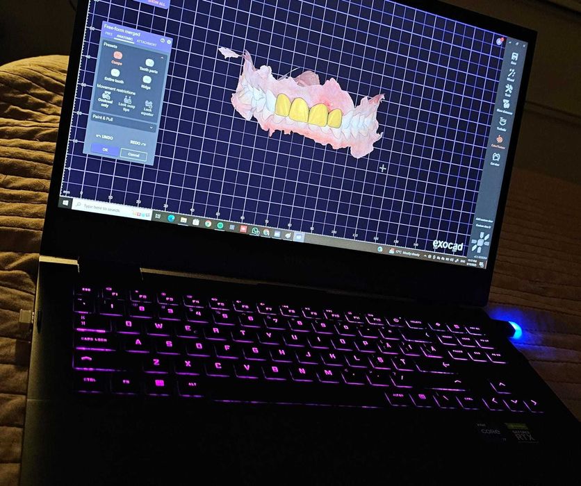 Laptop Gaming HP OMEN 16-b0000nq cu exocad