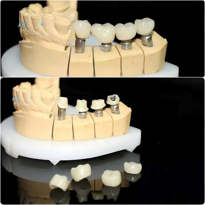Зуботехническая CAD/CAM услуги в стоматологии
