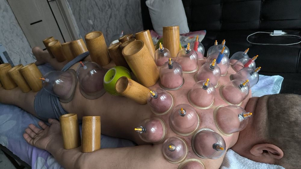 Массаж профессиональный хиджама