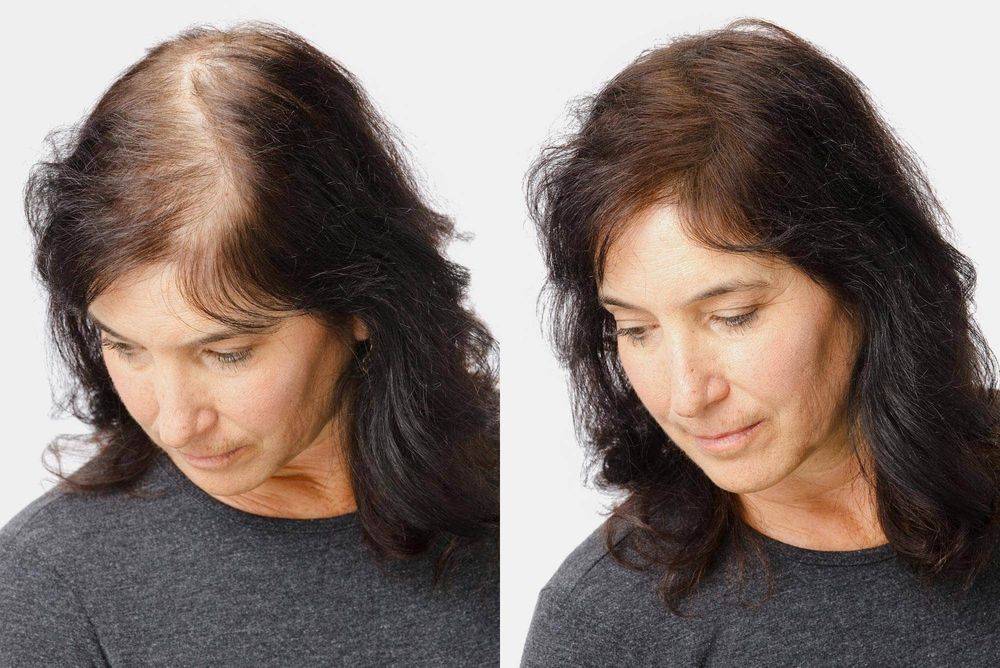 Tolyatti ayollari bilan jinsiy aloqa