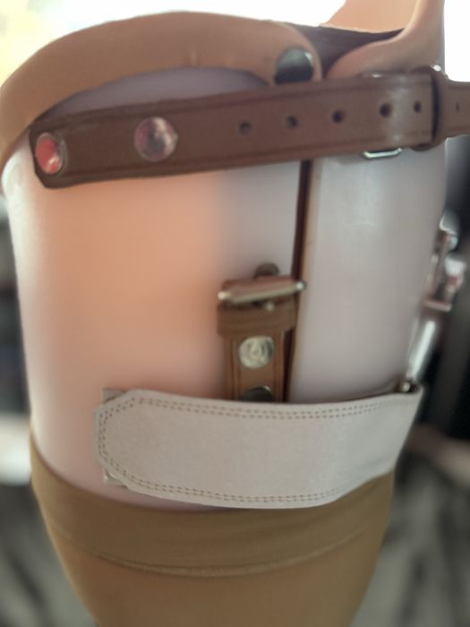 Proteza amputatie coapsa