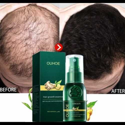 Серум спрей за по-бърз растеж на косата и против косопад