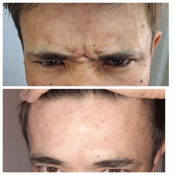 Депиляция г. АЛМАТЫ