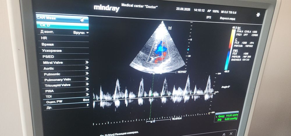 Миндрай дс7 узи аппарат