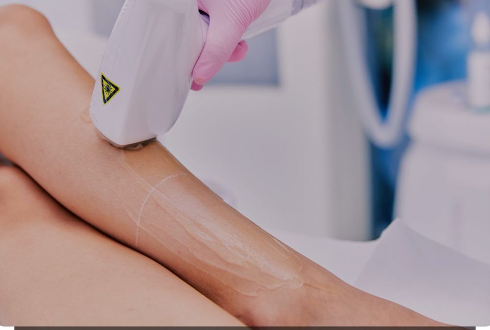 Epilare definitiva Full Body  - 350 lei oferta/ aprilie