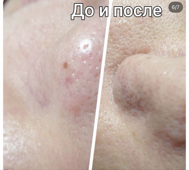 Шугаринг,косметология ,массаж