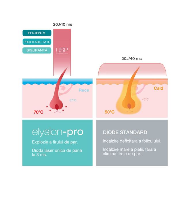 479 Ron Full Body Epilare Definitiva cu Laser Medical Elysion Pro