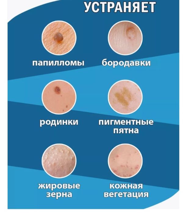 Косметический аппарат