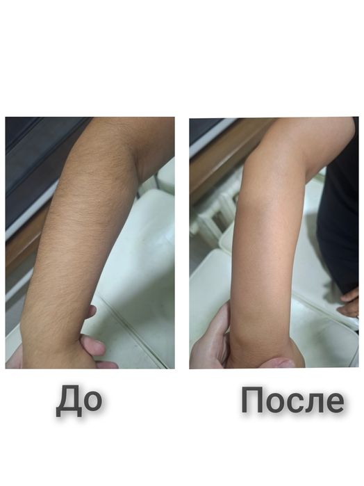 Восковая депиляция Итальянским и Китайским воском