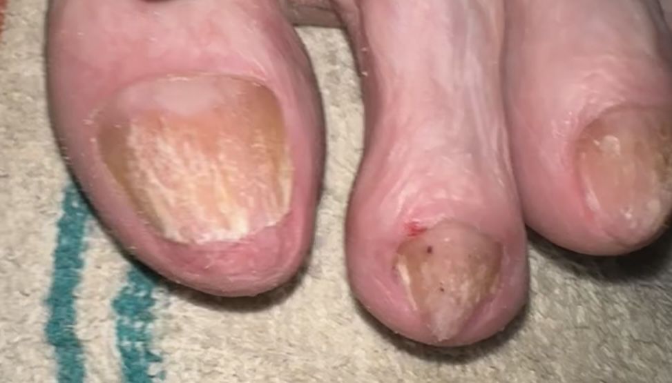 Педикюр с выездом на дом