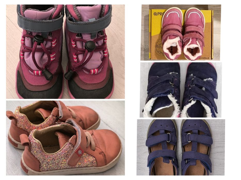 Боси обувки tikki ember 25, blifestyle 25, protetika 31, beda 31