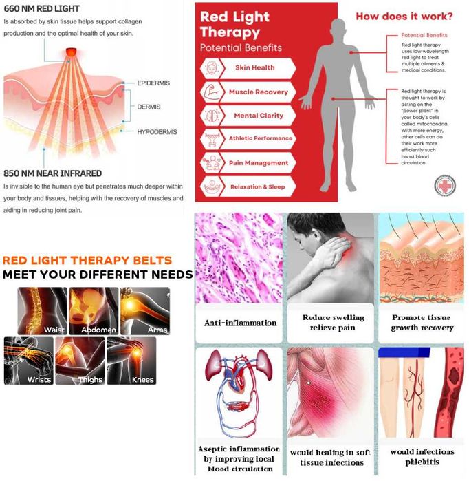Aparat fizioterapie lumina rosie