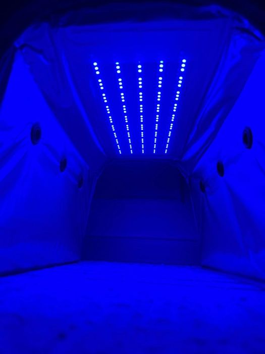 Фотолампа от желтушки