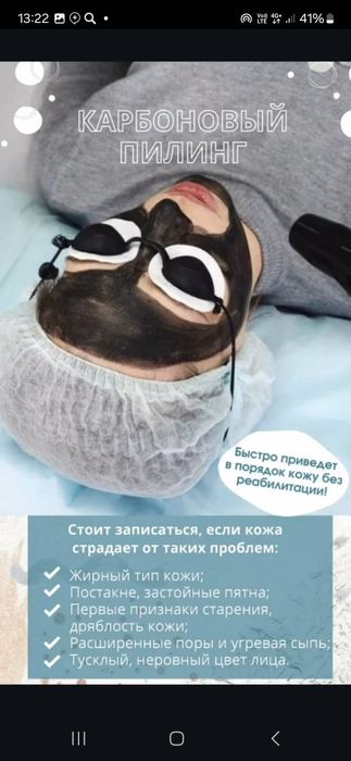 N yag lazer apparati . Udaleniya brovi. Karbon piling. Udaleniya tatu