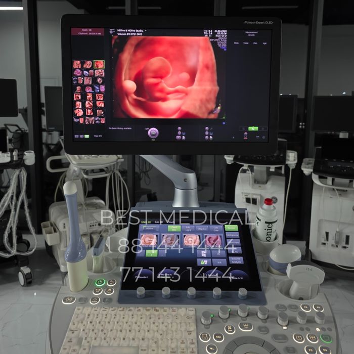 Узи аппарат GE Voluson E10