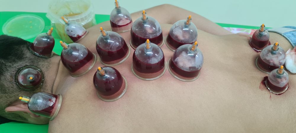 Хиджама клиникасы