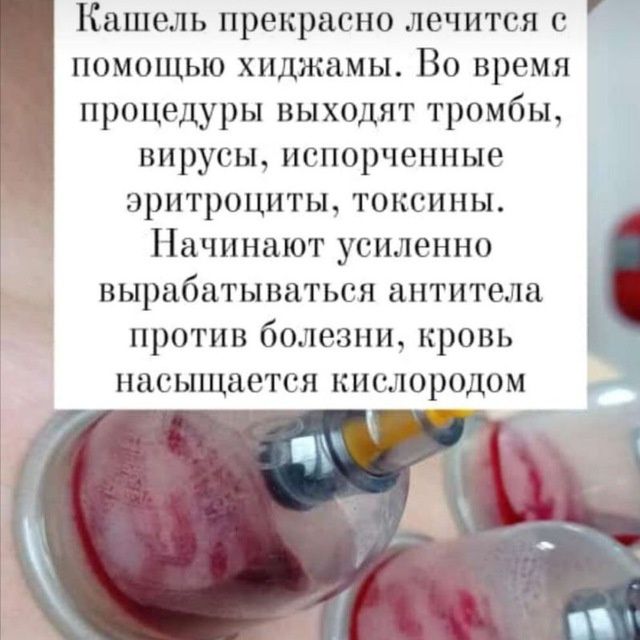 Банки для хиджамы с большим насосом. И насос