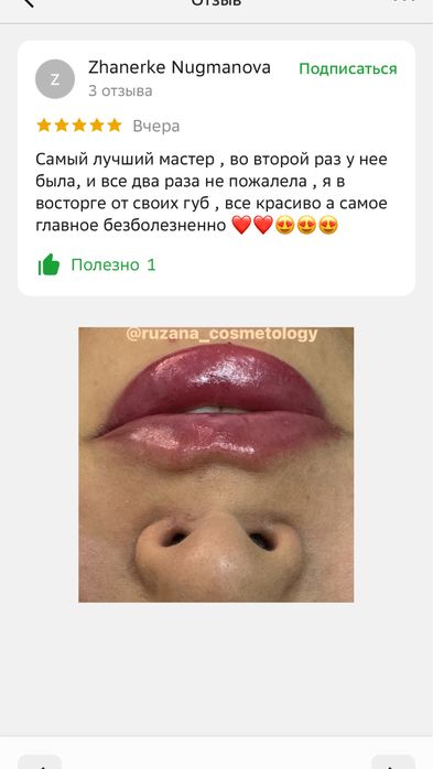 Акция губы, ботокс, чистка, плазма