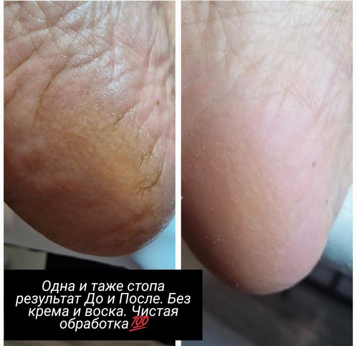 Маникюр и педикюр