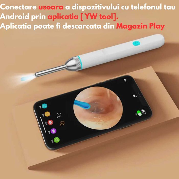 Otoscop smart, aparat pentru curatarea urechilor, UltraHD, Wi-Fi