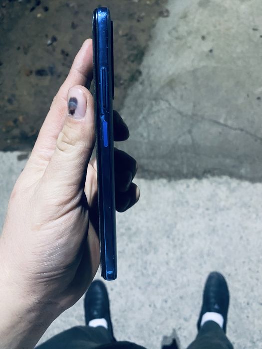 Redmi note 11 srochna