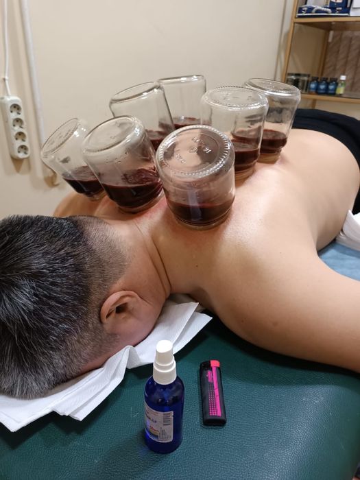 Хиджама,шертпе,ангина Алматы