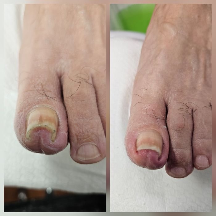 Pedichiură clasică și medicală