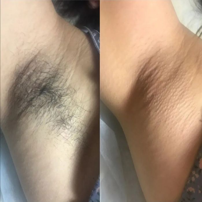 Шугаринг - район Жана Кала. Качественно!