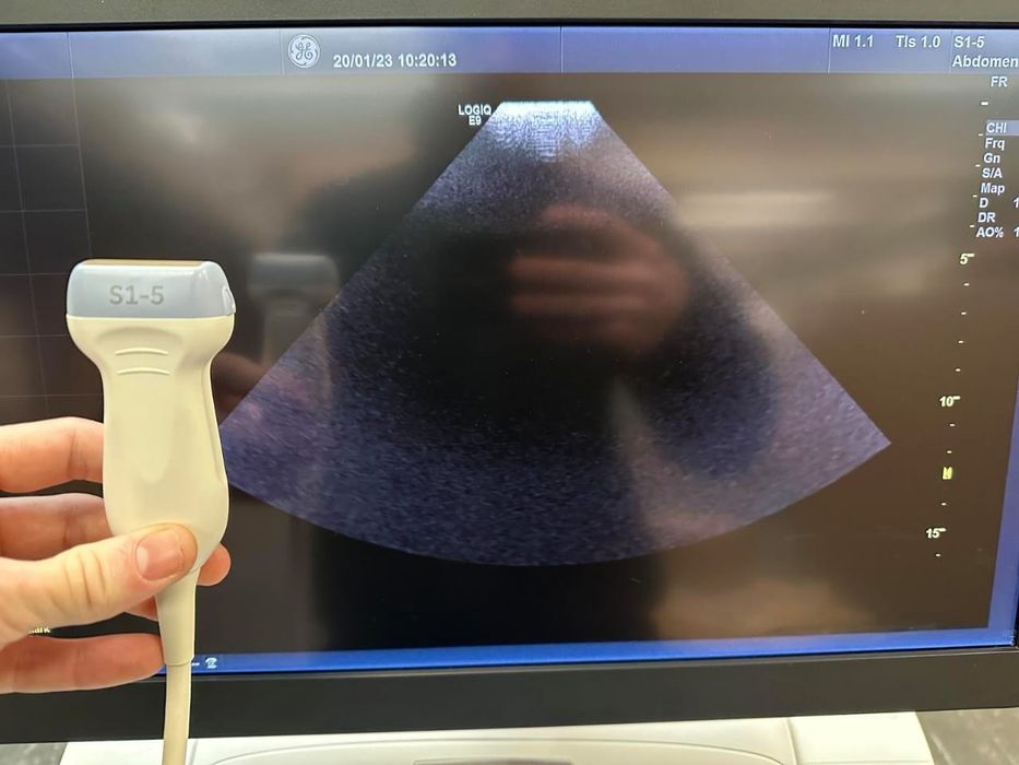 УЗИ АППАРАТ мед.оборудование