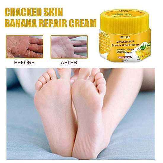Възстановяващ крем за крака и ръце, Предотвратява сухата напукана кожа