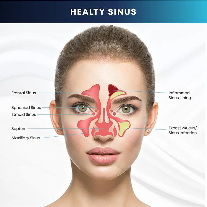 Комплект за промиване на синусите, бутилка 300 мл + 20 сашета