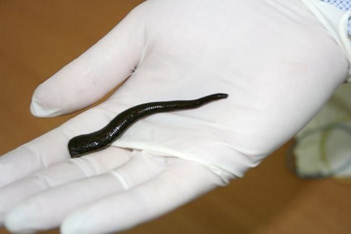 Zuluk Tibbiyot Zuluklari  Пия́вки