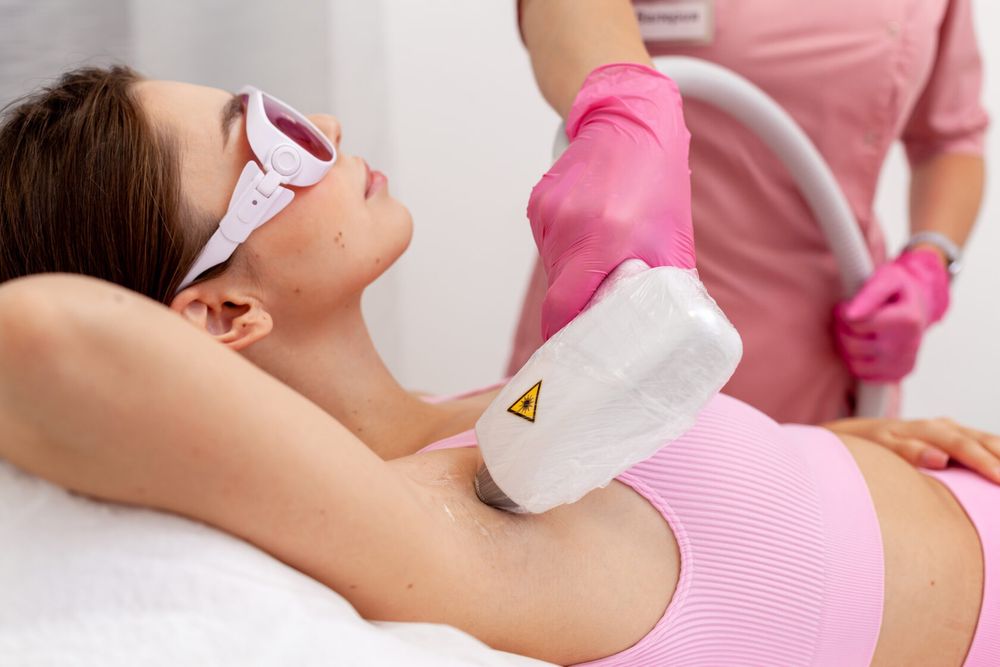 Лазерная эпиляция волос
