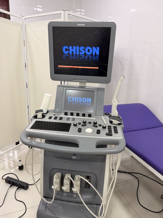 УЗИ аппарат экспертного класса