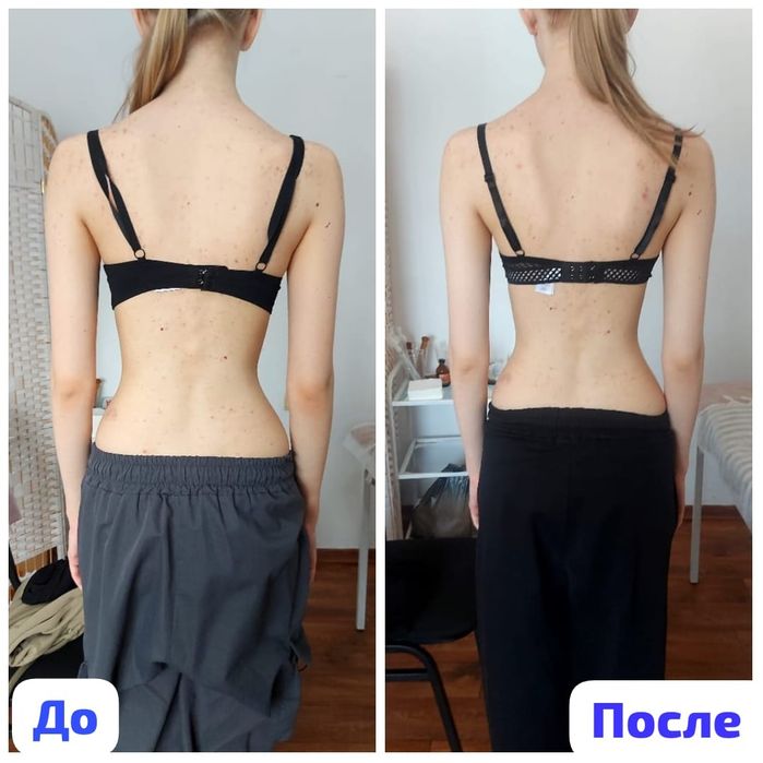 Мануальная терапия/массаж/иглотерапия