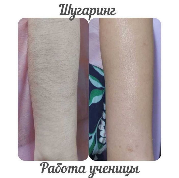Курсы по Шугарингу " АКЦИЯ "
