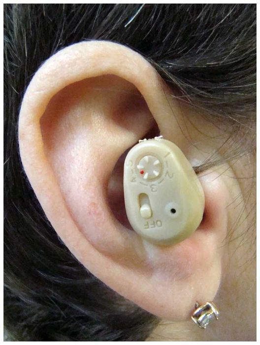 Слуховой Аппарат (Құлақ Аппараты)