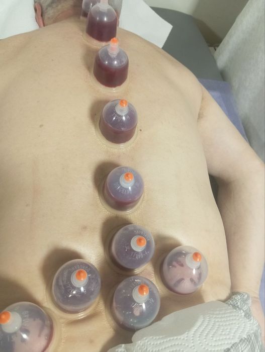 Hijoma zuluk med pratsedura