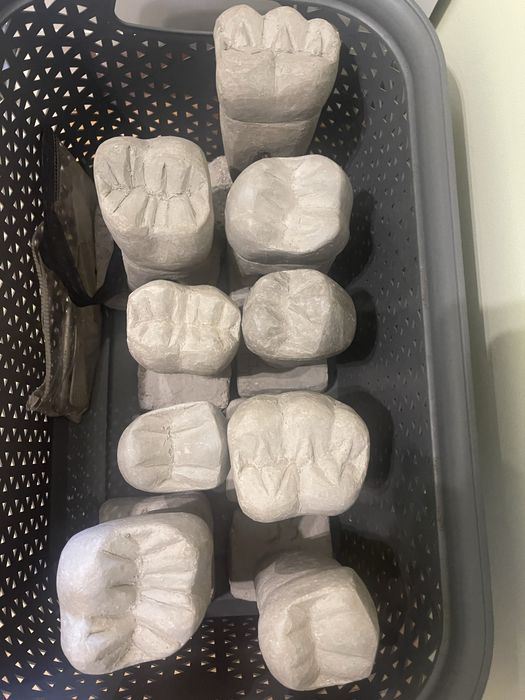 Макети на зъби за изпит по зъботехника