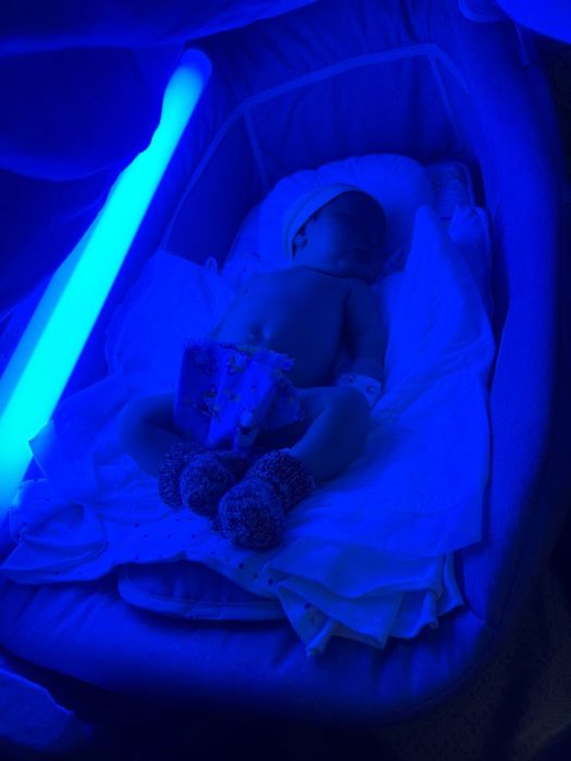 ФОТОЛампА. ЖелтушкА.