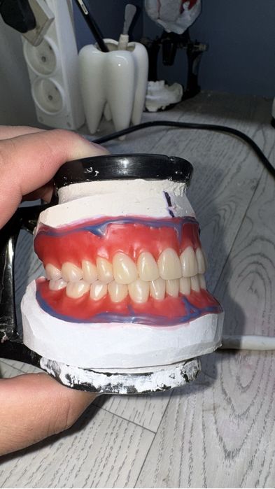 Протез жасаймыз.