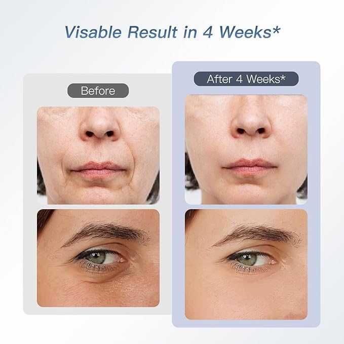 IBORRIA  Уред за лифтинг и за грижа за кожата на лицето 6-в-1