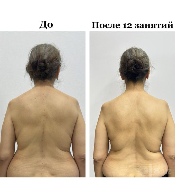 Тренер лечеьной физкультуры