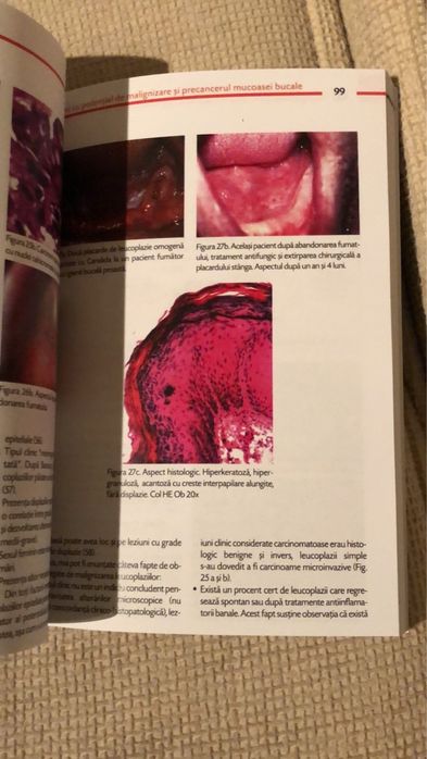 Medicina si Patologie Orala-TOVARU-VOL I / EDITIA A - II - A 2012